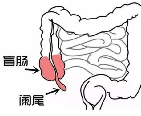 阑尾炎是哪个部位疼图片