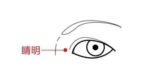 睛明穴的功效作用，睛明的准确位置图