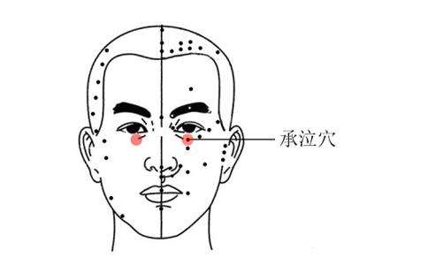 承泣穴的作用与功效，承泣的准确位置图片