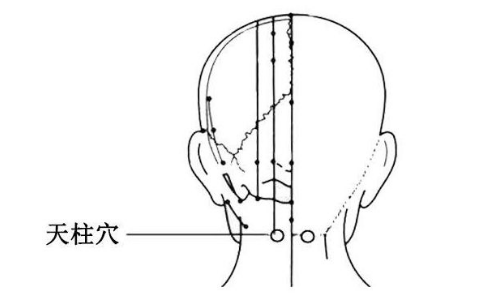 天柱穴在哪里,天柱的准确位置图片