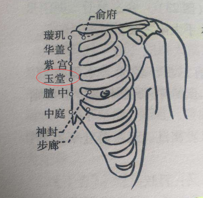 玉堂穴的最笨找法，玉堂的准确位置图片和作用