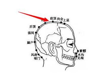 后顶穴的准确位置怎么找，后顶的准确位置图和作用