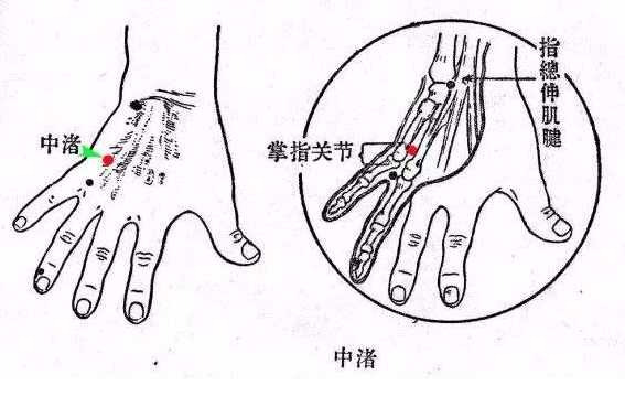 中渚穴的针刺正确方向，中渚的准确位置图片和作用