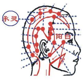 承灵穴的作用与功效，承灵的准位置图