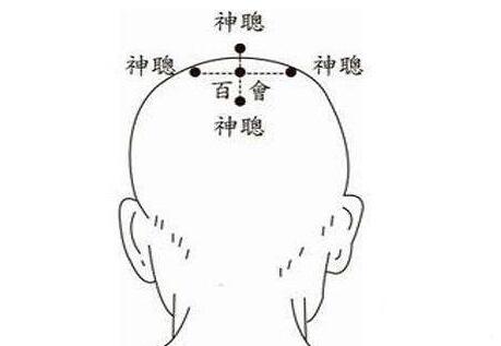 四神聪穴的功效与作用，四神聪的准确位置图