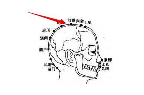 前顶穴的作用与功效，前顶的准确位置图片