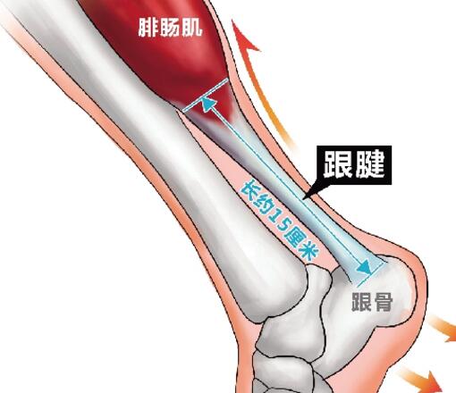 跟腱炎是哪个部位？跟腱炎按摩什么穴位好？