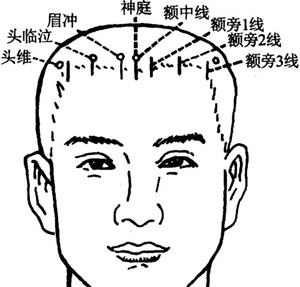 按摩神庭有什么作用？神庭的准确位置图