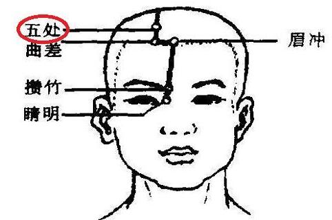 五处穴的简易找法，五处的准确位置图和作用